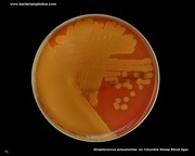 alpha-hemolysis on blood agar